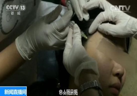 央视披露微整形专家 五天速成