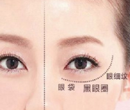 去黑眼圈