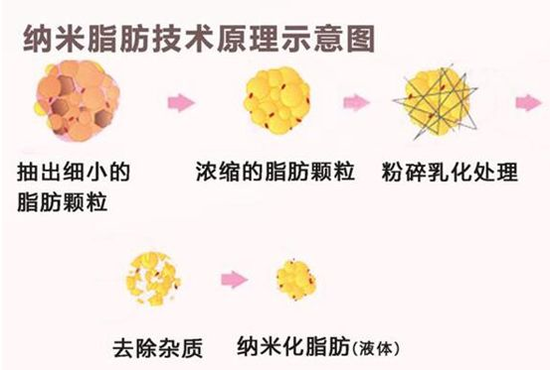 现在网上说的“纳米脂肪”到底什么？