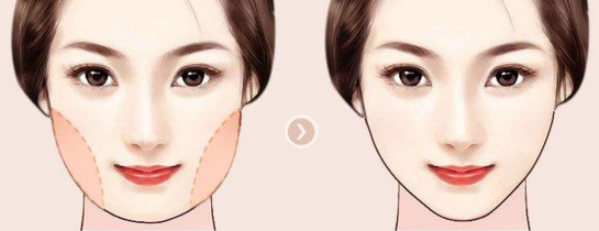 注射溶脂针瘦脸能管多长时间