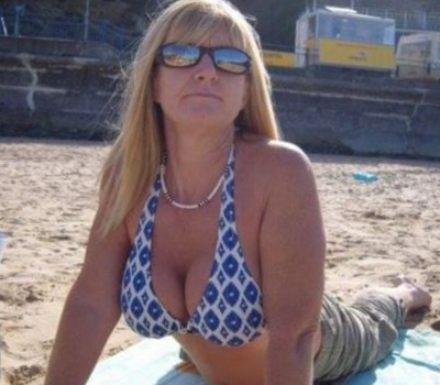 51岁英国女子4万元隆胸 硅胶假乳体内“爆炸”