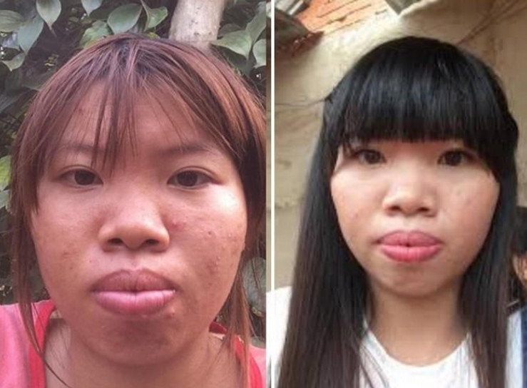 越南女子花十万整容 网友：现成功逆袭闪婚富少进豪门