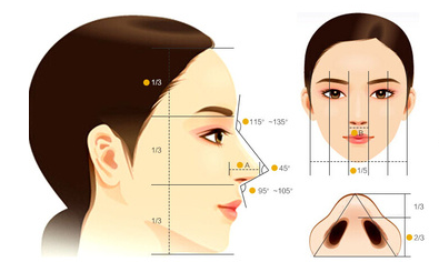 隆鼻失败的九大症状及修复方式