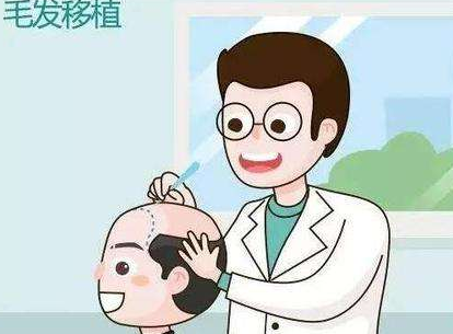头发种植过程很痛吗