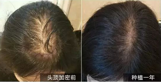 头发加密有什么优势