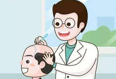 女性做头发种植需要注意些什么