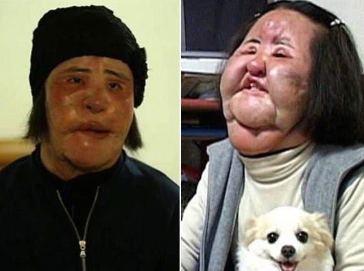 韩整容女星57岁过世，生前色拉油注入全脸9年无法闭眼