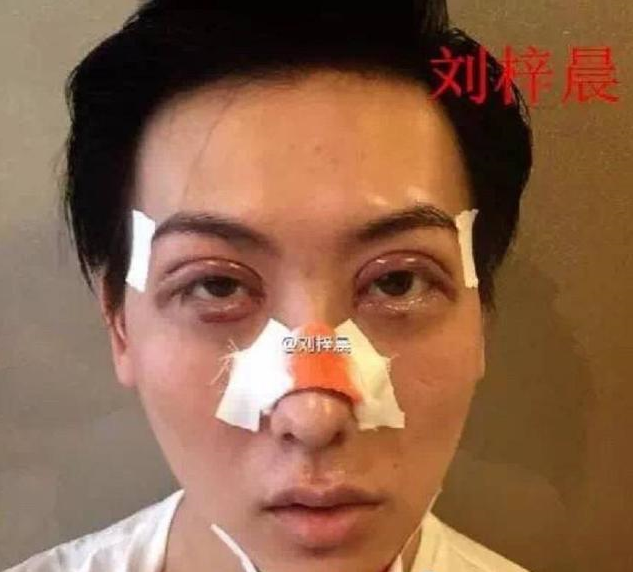 刘梓晨被美容院当做整容失败的案例 网友:他不整都已经很失败了