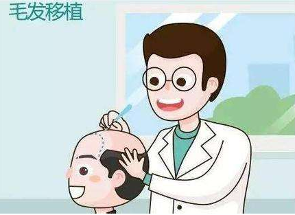 大连沙医生做头发种植是永久的吗