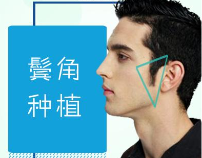 青岛洋美鬓角种植后还会脱落吗