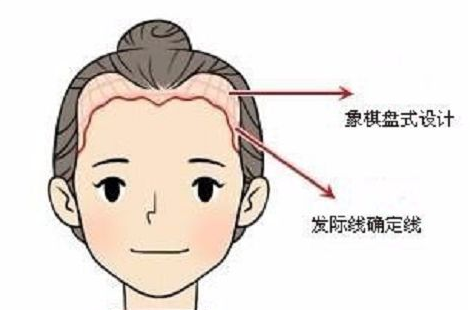 太原丽都美人尖种植 好看美人尖种出来