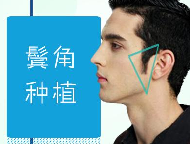 上海江城鬓角种植 做个有魅力的男人