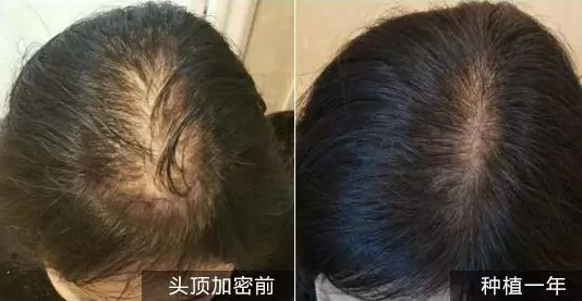 安徽维多利亚SHT头发加密 让您再美一点