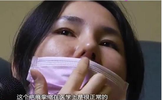 女子整形鼻子一大一小，影响正常呼吸，医生：这在医学上很正常！