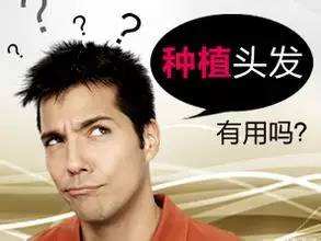 头发种植后多久可以洗头