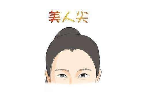 武汉武总植发医院美人尖种植 让你美美哒