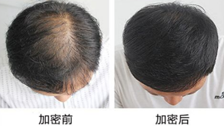 成都华美紫馨头发加密 提升你的魅力值