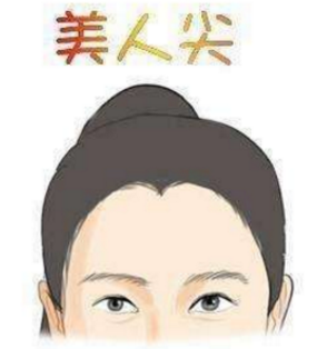 郑州美莱 美人尖让你更美