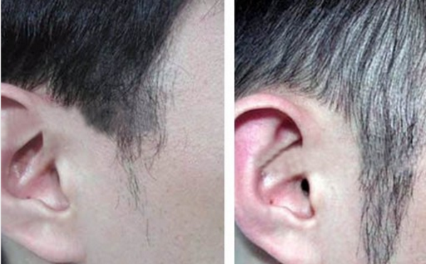 厦门雍禾鬓角种植有什么优势  价格贵吗