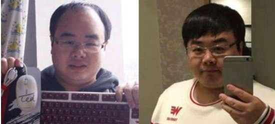 发际线过高怎么调整 天津友好有哪些优势