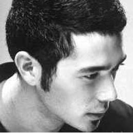 鬓角移植  彰显完美男人本色