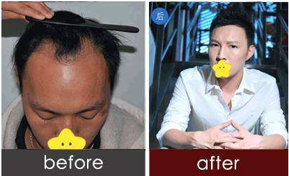 上海时光头发加密效果怎么样  安全吗