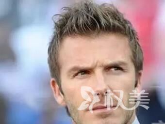 合肥雍禾植鬓角多少钱 还会再次脱落吗