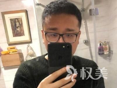 笑笑植发成功了吗 珠海新生头发加密效果怎么样
