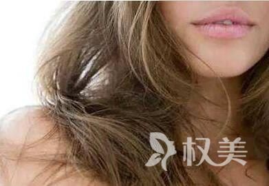头发干枯毛躁小窍门 合肥丽人发际线种植让头发更美