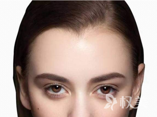 美人尖适合什么发型 种植美人尖手术疼吗