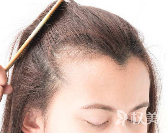 美人尖是怎么种植的 美人尖种植疼痛吗