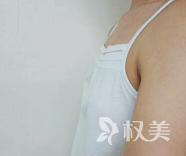 我选择了浙江大学邵逸夫医院整形科自体脂肪隆胸术 塑身丰胸一举两得 