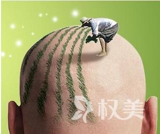 头发为什么一直掉  头发加密对原来的头发有什么影响