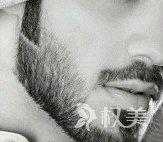 胡须种植效果可靠吗 北京南加美学胡须种植需要多少钱