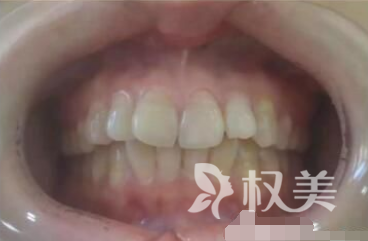 黑龙江佳木斯大学口腔医学院牙齿矫正 一段充满奇妙的旅程