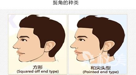 郑州植发哪家医院好 鬓角种植有什么特点
