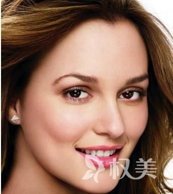 额头脱发导致美人尖消失怎么办 美人尖种植的优点有哪些