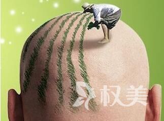 秃顶的原因有哪些 头发种植靠谱吗