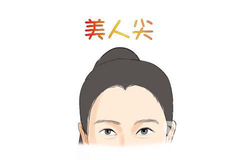 怎么才能有效的预防脱发 美人尖种植后多久可以恢复