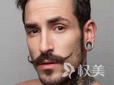掉头发去什么医院 胡须种植有效果吗
