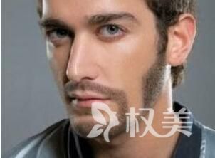 广州哪家医院好 胡须种植价格贵吗
