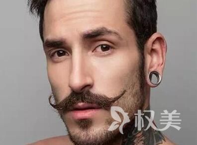 老是掉头发怎么回事 北京植发医院排行榜