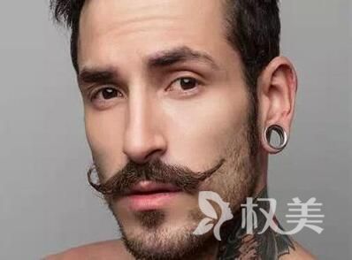 植发后需要多少时间恢复 北京胡须种植哪里好