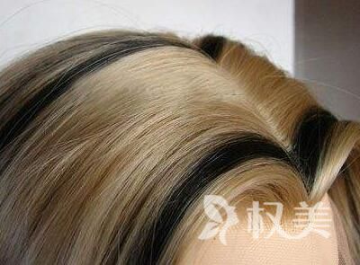 掉头发是肾虚吗 西安美人尖种植医院排名