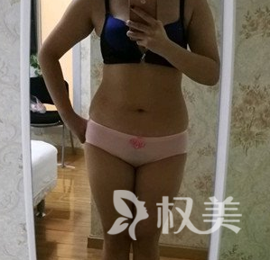 水动力吸脂瘦腰腹 一针“吸”走大肚子 安全变美 享“瘦”今生