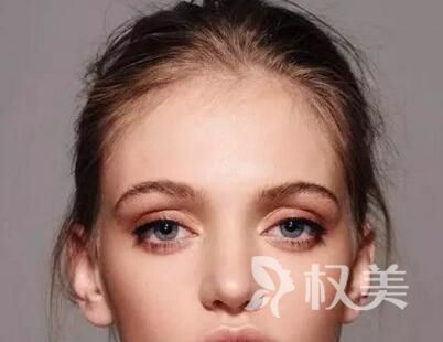 发际线后移擦生姜行吗 武汉新生毛发种植医院植发怎么样