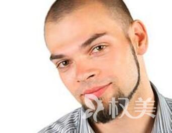辽宁植胡须哪家医院比较好 胡须种植优势有哪些