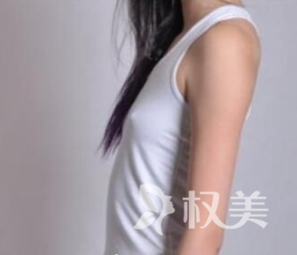 我在广州晨曦整形医院做娜绮丽水滴假体隆胸 不硬化不变形让胸部很出彩