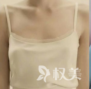 从A到D大不一样 我在安庆现代医学美容医院 体验假体隆胸 真的美丽  