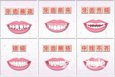 佛山第一人民医院整形科做牙齿矫正的优势有哪些  矫正方法有几种